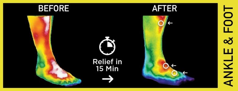 pain relief disc